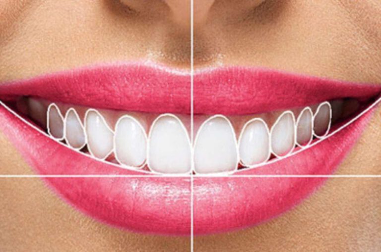 smile designing min 1